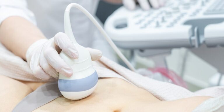 Sindrome PCOS e fertilità